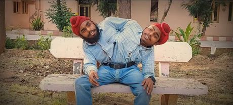 Sijamski blizanci Indija
