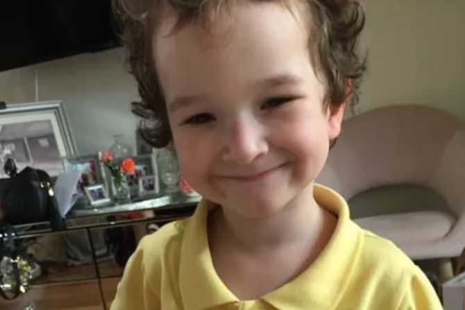 Manny dečak pet godina pas napad Australija Manny dečak pet godina pas napad Australija