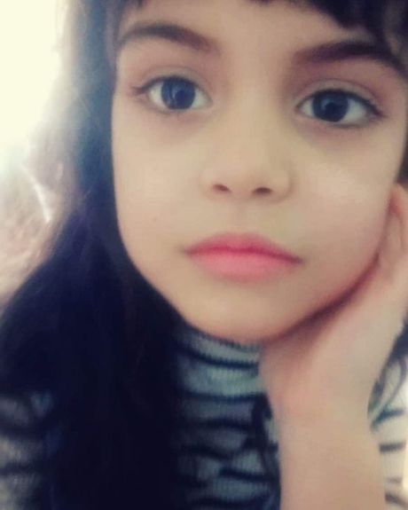 Lana Stefanović, epilepsija