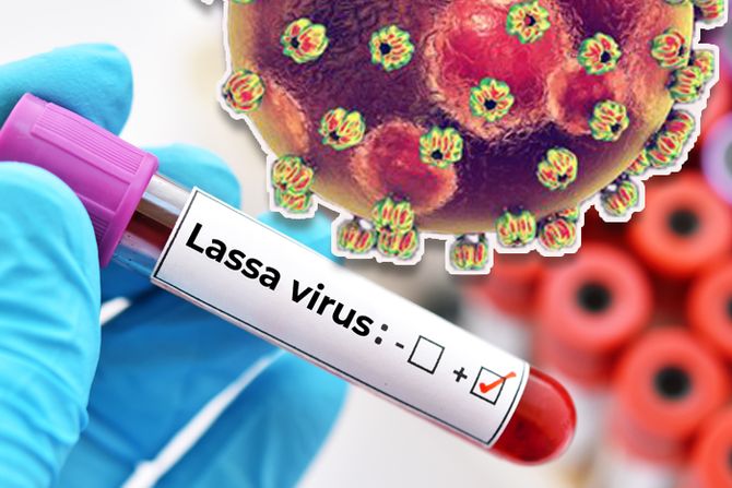 Lassa fever viruses Lasa virus