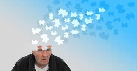 demencija, zaboravnost, zaboravljanje, mozak, Alchajmerova bolest