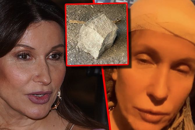 Snežana Dakić kamen glava povreda Snežana Dakić kamen glava povreda