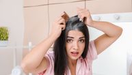 Naučnici na pragu otkrića sprečavanja kose da posedi: Evo zbog čega se to prvobitno dešava