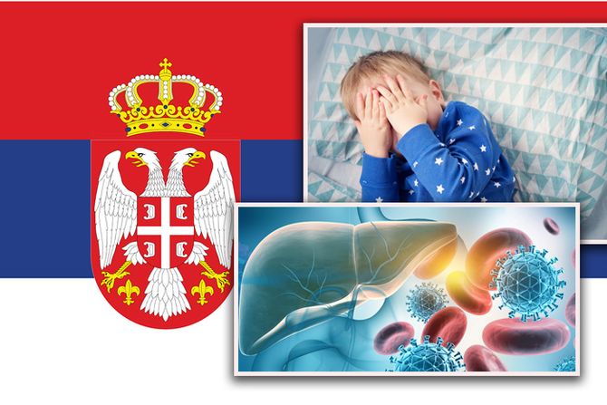 Hepatitis Srbija dete