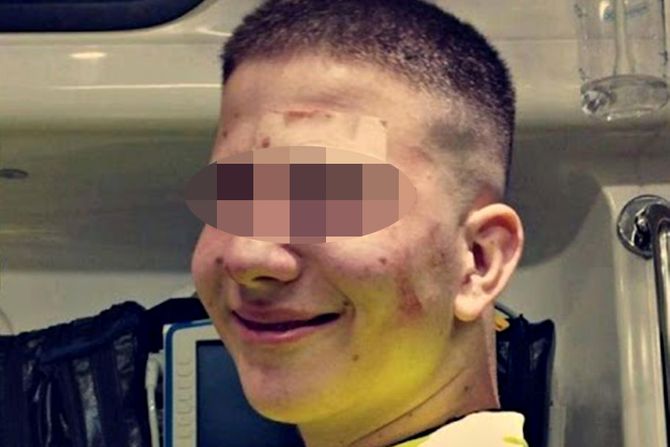 Aleksa Bojanić, klub Aleksa Bojanić, klub