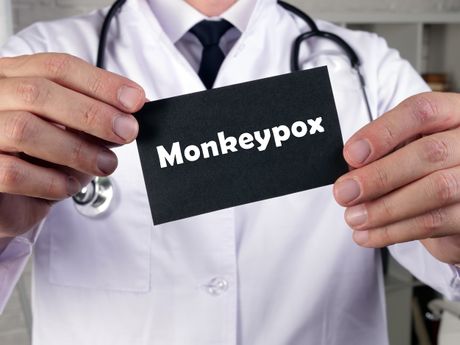Monkeypox majmunske boginje