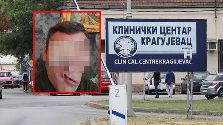 Klinicki centar Kragujevac, Miloš Stefanović
