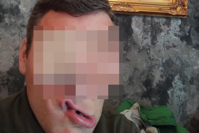 Miloš Stefanović,  Kragujevac, pokušaj ubistva Miloš Stefanović,  Kragujevac, pokušaj ubistva