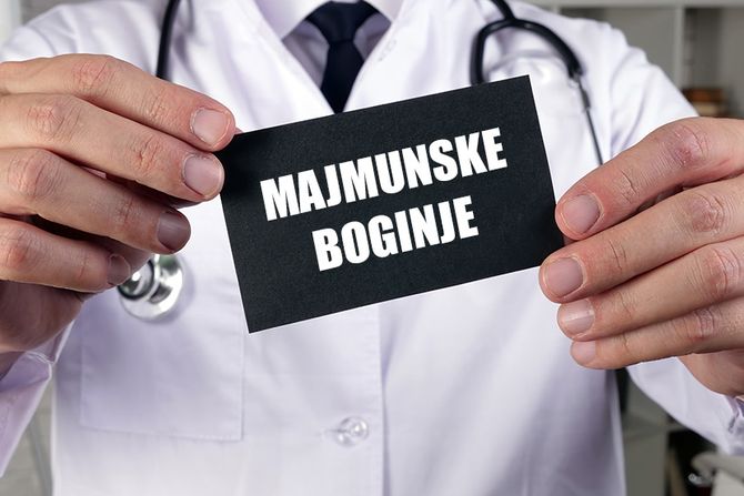 Majmunske boginje, monkeypox