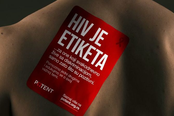 HIV je etiketa