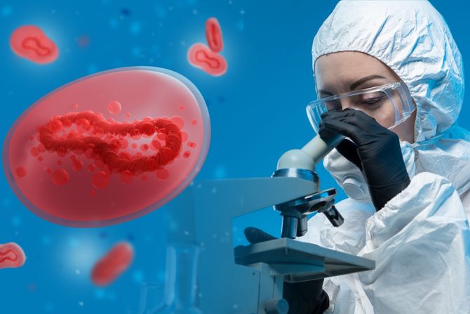 Monkeypox, majmunske boginje Monkeypox, majmunske boginje