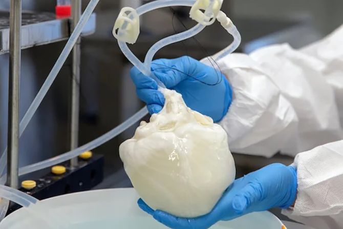 srce svinje čovek transplantacija srce svinje čovek transplantacija