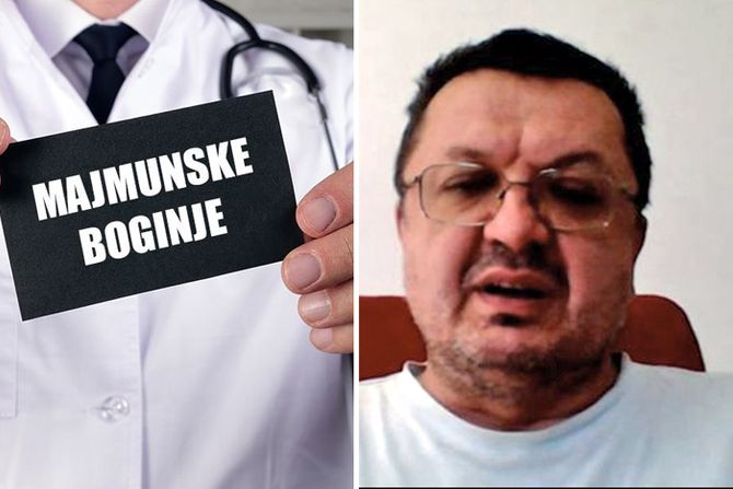 Milanko Šekler, Majmunske boginje, monkeypox