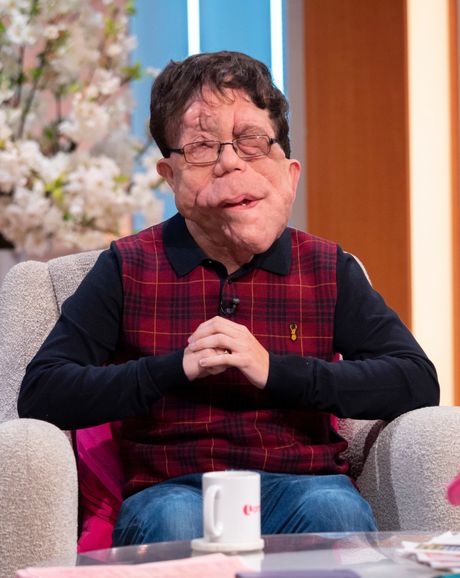 Adam Pearson Adam Pearson