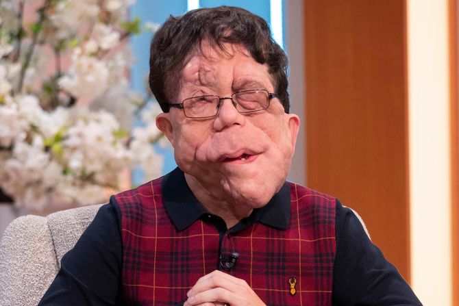 Adam Pearson