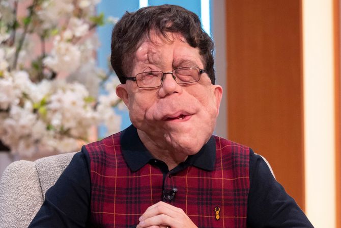 Adam Pearson Adam Pearson