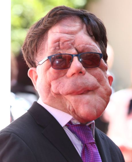 Adam Pearson Adam Pearson