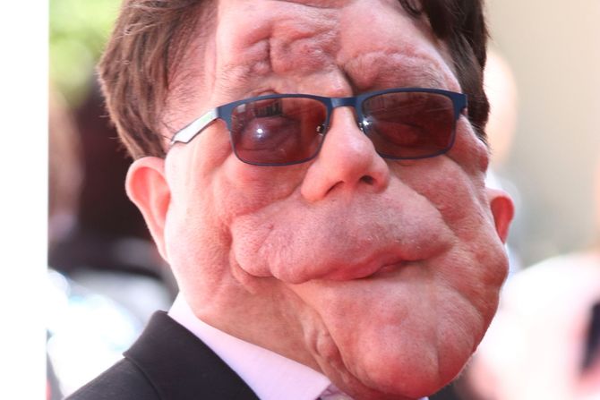 Adam Pearson Adam Pearson