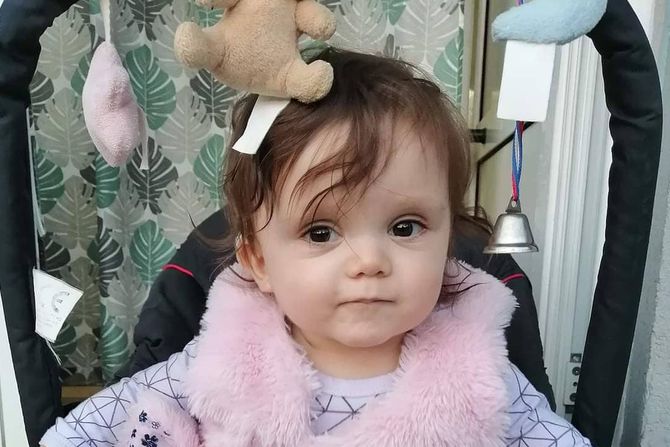 Iva Antonijević, Tarnerov sindrom Iva Antonijević, Tarnerov sindrom