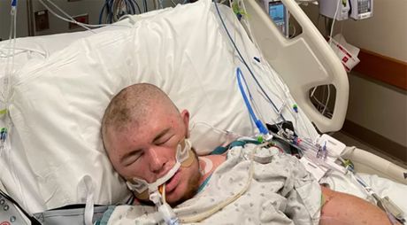 Ostin Belami Austin Bellamy pčele koma