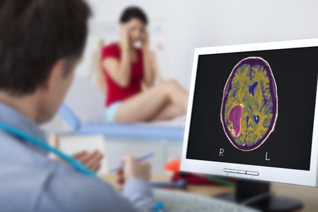 Mozak, tumor, lekarski pregled