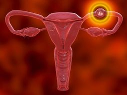 Vanmaterična trudnoća