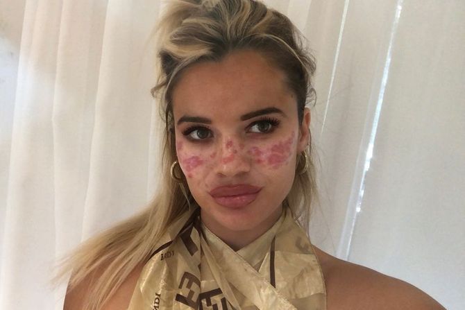 Tili Vitfild Tili Vitfild