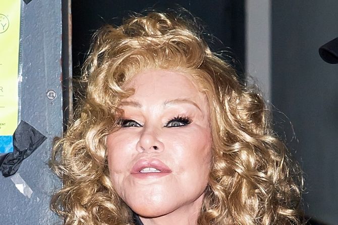 Jocelyn Wildenstein Jocelyn Wildenstein
