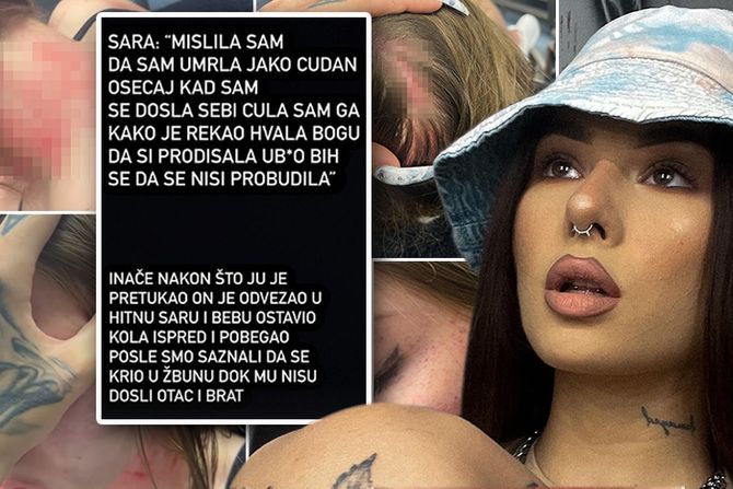 Una Kablar Uki Q Sara Hadžić povreda sestra Instagram poruka