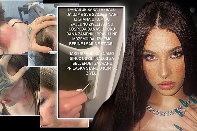 Una Kablar Uki Q Sara Hadžić povreda sestra Instagram poruka 2