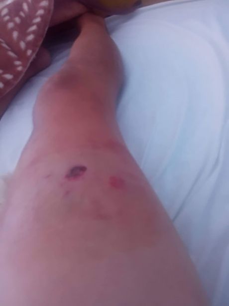 Albanac upucao Srbina diskoteka  Gračanica