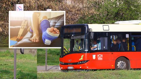 Autobus, ženska noga u gipsu, ženi prešao autobus preko noge