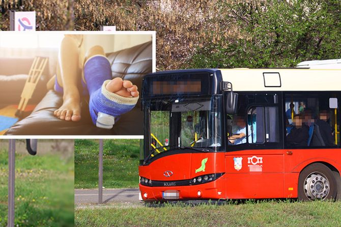 Autobus, ženska noga u gipsu, ženi prešao autobus preko noge