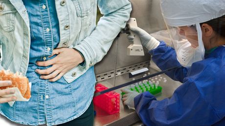 Bolovi u stomaku tinejdžeri trovanje mikrobiolog