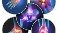 Ultra retka bolest: "Crne kosti" pogađa jednog čoveka u milion, simptomi su lako uočljivi