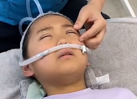 Japan kozmeticke operacije deca