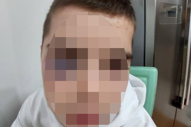 Pretučeni dečak, Surdulica Pretučeni dečak, Surdulica
