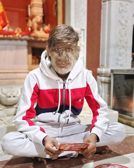 Lalit Patel Lalit Patel