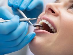 desni, zubi, zubar, pregled