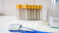 U Srbiji organizovano besplatno testiranje na HIV i druge polne infekcije povodom Evropske nedelje testiranja