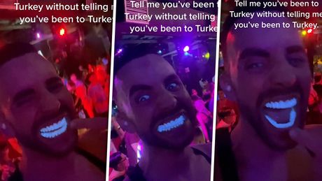 Zubi Turska diskoteka Tiktok