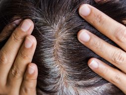 skalp starenje seda kosa koža