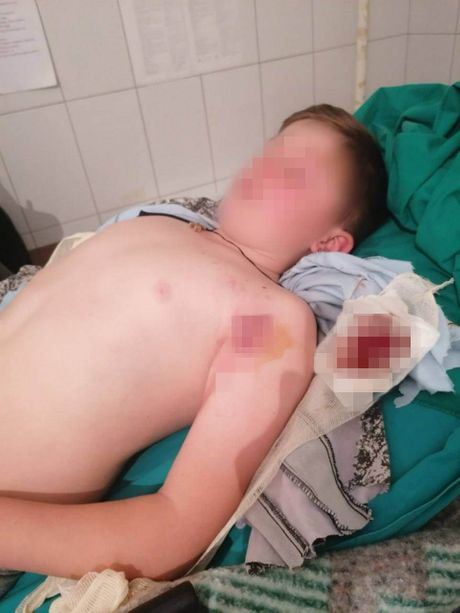 Dečak, ranjeni dečak, Kosovo