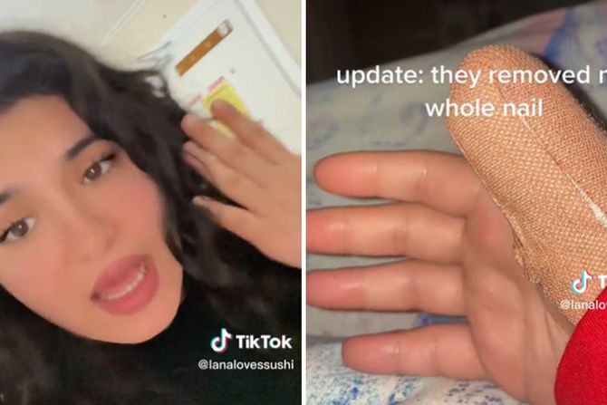 Lana nokat Lana nokat