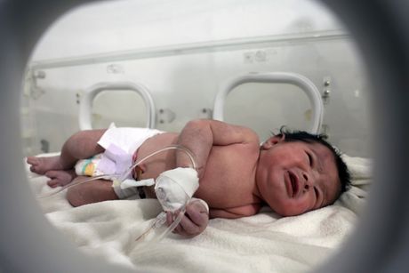 Beba, devojčica, rođena pod ruševinama u Siriji
