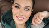 Tamara Ćosić bez filtera: Sve estetske i neinvazivne tretmane koje je radila na svom licu otkriva javno