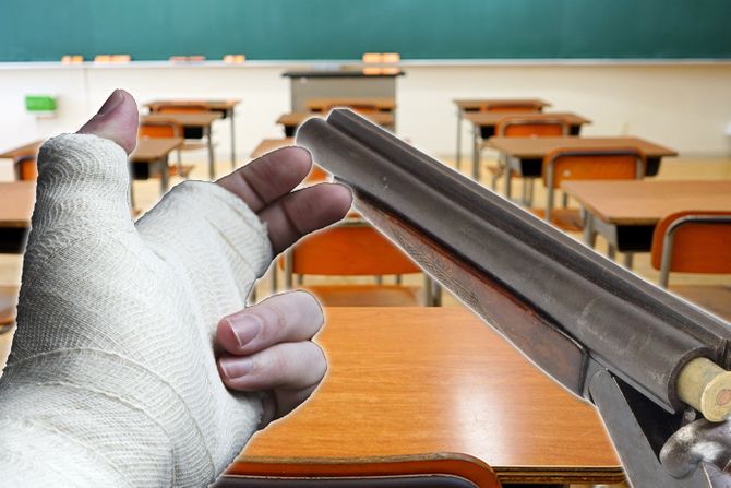 Škola gips puška Škola gips puška