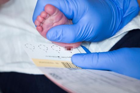 Gatrijev test, guthrie test, neonatalni skrining