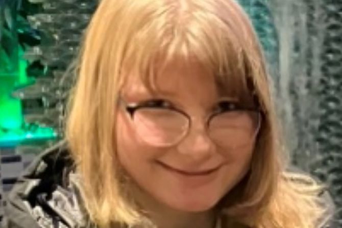 Albina Yevko Albina Yevko