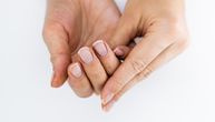 Krhki nokti i suva koža mogu da signaliziraju nedostatak omega-3 masti: Evo zašto je to opasno